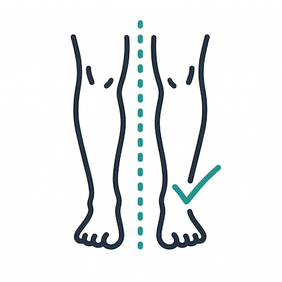 Foot alignment